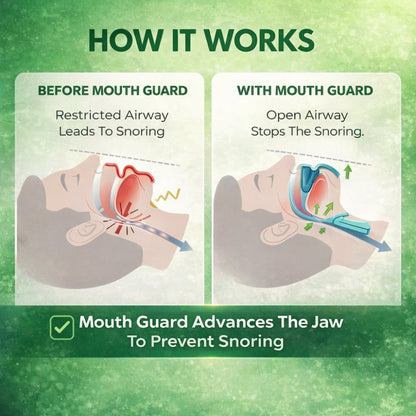 Nurtava™ Anti-Snoring Mouthpiece